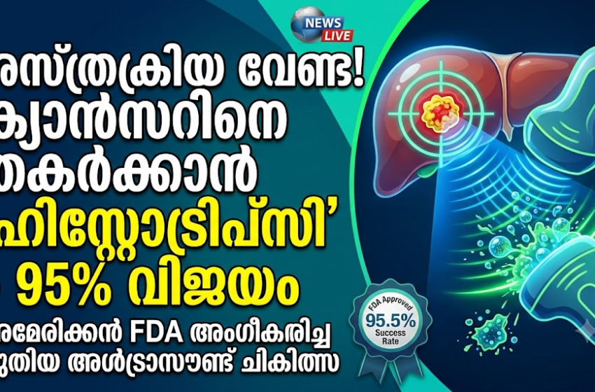  കരൾ അർബുദ ചികിത്സയിൽ വിപ്ലവവുമായി ‘ഹിസ്റ്റോട്രിപ്സി’; യു.എസ് എഫ്.ഡി.എ അംഗീകരിച്ച അത്യാധുനിക അൾട്രാസൗണ്ട് സാങ്കേതികവിദ്യ