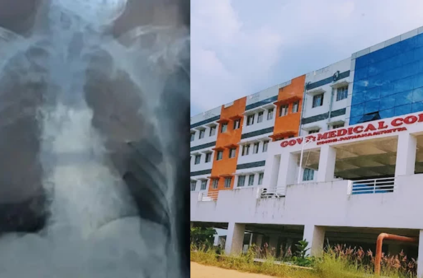  കോന്നി മെഡിക്കൽ കോളജിൽ ഗുരുതര വീഴ്ച: 16-കാരിക്ക് നൽകിയത് 88-കാരിയുടെ എക്സ് റേ; നട്ടെല്ലിന് വളവെന്ന് കണ്ടെത്തി ഡോക്ടർ